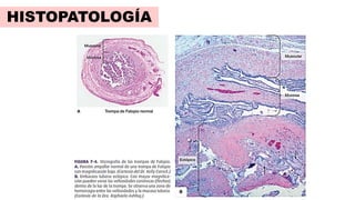 HISTOPATOLOGÍA
 