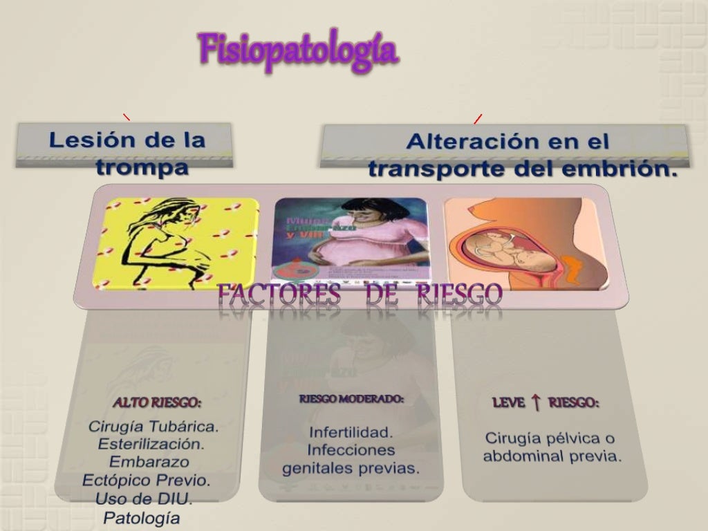 Embarazo Ectopico Cuidados de enfermería