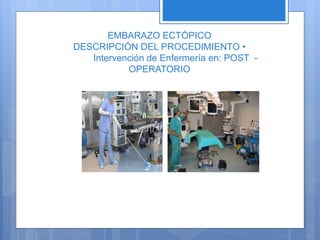 EMBARAZO ECTÓPICO
DESCRIPCIÓN DEL PROCEDIMIENTO •
Intervención de Enfermería en: POST -
OPERATORIO
 
