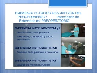 EMBARAZO ECTÓPICO DESCRIPCIÓN DEL
PROCEDIMIENTO • Intervención de
Enfermería en: PREOPERATORIO
 