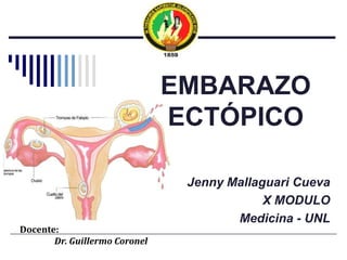 EMBARAZO ECTÓPICO Jenny Mallaguari Cueva X MODULO Medicina - UNL Docente: 	Dr. Guillermo Coronel 