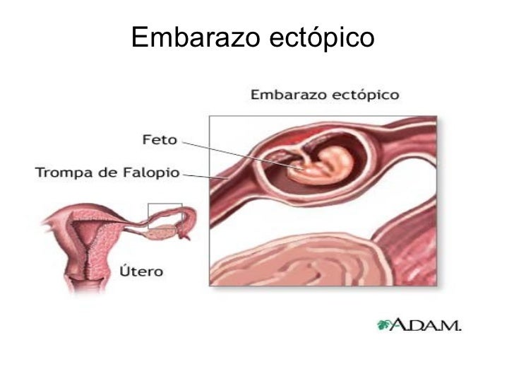 Dejar fumar la comida