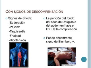 CON SIGNOS DE DESCOMPENSACIÓN
 Signos de Shock:
-Sudoración
-Palidez
-Taquicardia
-Frialdad
-Hipotensión
 La punción del fondo
del saco de Douglas o
del abdomen hace el
Dx. De la complicación.
 Puede encontrarse
signo de Blumberg +.
 