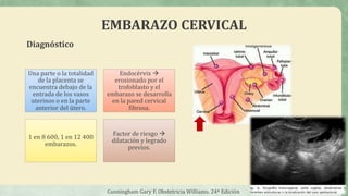 EMBARAZO CERVICAL
Diagnóstico
Una parte o la totalidad
de la placenta se
encuentra debajo de la
entrada de los vasos
uterinos o en la parte
anterior del útero.
Endocérvix 
erosionado por el
trofoblasto y el
embarazo se desarrolla
en la pared cervical
fibrosa.
1 en 8 600, 1 en 12 400
embarazos.
Factor de riesgo 
dilatación y legrado
previos.
Cunningham Gary F, Obstetricia Williams. 24ª Edición
 
