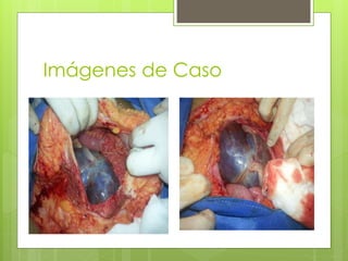 Imágenes de Caso
 