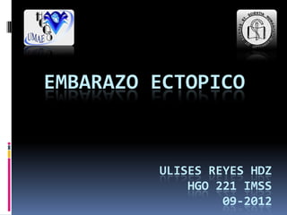 EMBARAZO ECTOPICO
ULISES REYES HDZ
HGO 221 IMSS
09-2012
 