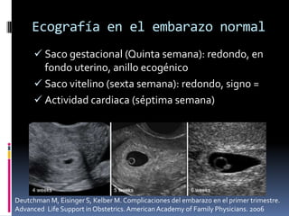 Ecografía en el embarazo normal
 Saco gestacional (Quinta semana): redondo, en
fondo uterino, anillo ecogénico
 Saco vit...