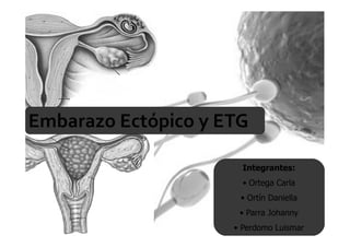 Embarazo Ectópico y ETG

                       Integrantes:
                       • Ortega Carla
                      • Ortín Daniella
                      • Parra Johanny
                     • Perdomo Luismar
 