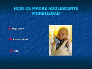 HIJO DE MADRE ADOLESCENTE MORBILIDAD Bajo  peso Prematuridad RCIU 