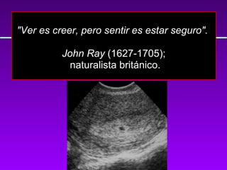 "Ver es creer, pero sentir es estar seguro".  John Ray  (1627-1705); naturalista británico. 