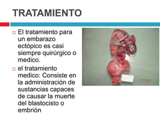 TRATAMIENTO
El tratamiento para
un embarazo
ectópico es casi
siempre quirúrgico o
medico.
el tratamiento
medico: Consiste en
la administración de
sustancias capaces
de causar la muerte
del blastocisto o
embrión