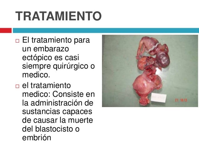 El dolor en la espalda y subfebrilnaya la temperatura
