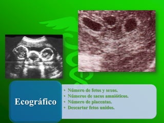 •   Número de fetos y sexos.
             •   Números de sacos amnióticos.
Ecográfico   •
             •
                 Número de placentas.
                 Descartar fetos unidos.
 