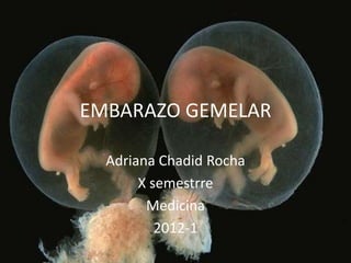 EMBARAZO GEMELAR

  Adriana Chadid Rocha
       X semestrre
        Medicina
          2012-1
 