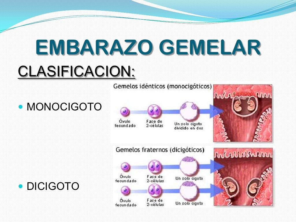 Embarazo gemelar