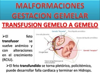 TRANSFUSION GEMELO A GEMELO
El feto
transfusor se
vuelve anémico y
con alteraciones
en el crecimiento
(RCIU).
El feto tr...