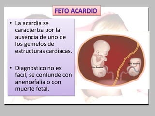 • La acardia se
caracteriza por la
ausencia de uno de
los gemelos de
estructuras cardiacas.
• Diagnostico no es
fácil, se confunde con
anencefalia o con
muerte fetal.
 