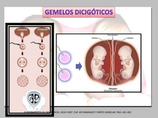 FUNDAMENTOS DE OBSTETRICIA, SEGO 2007. CAP. 49 EMBARAZO Y PARTO GEMELAR. PAG. 401-402
 
