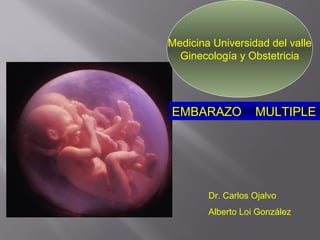 EMBARAZO MULTIPLE
Dr. Carlos Ojalvo
Alberto Loi González
Medicina Universidad del valle
Ginecología y Obstetricia
 