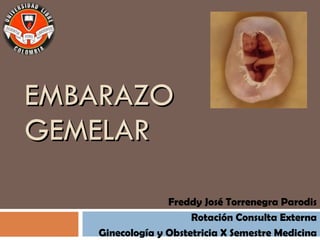EMBARAZO GEMELAR Freddy José Torrenegra Parodis Rotación Consulta Externa Ginecología y Obstetricia X Semestre Medicina 