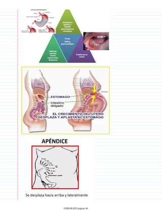 EMBARAZO página 46
 
