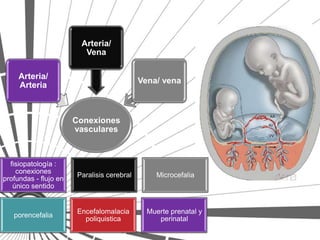 Arteria/
                          Vena

     Arteria/
                                            Vena/ vena
     Arteria



                       Conexiones
                       vasculares



  fisiopatología :
    conexiones
                       Paralisis cerebral       Microcefalia
profundas - flujo en
   único sentido


                        Encefalomalacia       Muerte prenatal y
   porencefalia
                          poliquistica           perinatal
 