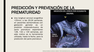PREDICCIÓN Y PREVENCIÓN DE LA
PREMATURIDAD
■ Una longitud cervical ecográfica
<25mm, a las 20-24 semanas,
en pacientes asintomáticas con
gestación gemelar es un
predictor moderado-bueno de
parto prematuro espontáneo
<28, <32 y <34 semanas, por
este motivo es la herramienta
utilizada, hasta la fecha, para la
predicción del parto prematuro.
PROTOCOLO DE BARCELONA, ASISTENCIA AL EMBARAZO Y PARTO DE GESTACIONES MULTIPLES . Hospital Clinic, Hospital Sant Joan de Déu, Universidad de Barcelona.
 