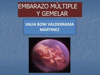 EMBARAZO MÚLTIPLE
Y GEMELAR
VALIA BONI VALDERRAMA
MARTINEZ
 