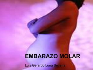EMBARAZO MOLAR
Luis Gerardo Luna Becerra
1
 