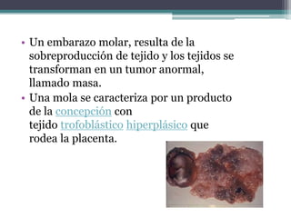 • Un embarazo molar, resulta de la
sobreproducción de tejido y los tejidos se
transforman en un tumor anormal,
llamado masa.
• Una mola se caracteriza por un producto
de la concepción con
tejido trofoblástico hiperplásico que
rodea la placenta.
 