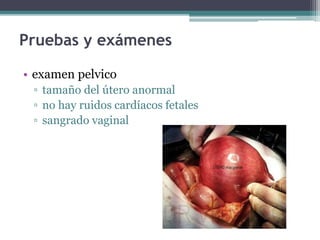 Pruebas y exámenes
• examen pelvico
▫ tamaño del útero anormal
▫ no hay ruidos cardíacos fetales
▫ sangrado vaginal
 