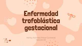 Ashley Atzimba Pintor Contreras
Sección 05
Enfermedad
trofoblástica
gestacional
 