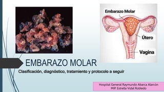 EMBARAZO MOLAR
Clasificación, diagnóstico, tratamiento y protocolo a seguir
Hospital General Raymundo Abarca Alarcón
MIP. Estrella Vidal Robledo
 