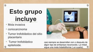 Esto grupo
incluye
• Mola invasiva
• coriocarcinoma
• Tumor trofoblástico del sitio
placentario
• Tumor trofoblástico
epitelioide.
casi siempre se desarrollan con o después de
algún tipo de embarazo reconocido. La mitad
sigue una mola hidatidiforme ( un cuarto)
 