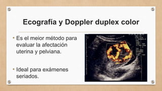 Ecografía y Doppler duplex color
• Es el meior método para
evaluar la afectación
uterina y pelviana.
• Ideal para exámenes
seriados.
 