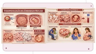 Comprehensive Overview of Ectopic and Molar Pregnancies: Diagnosis ...