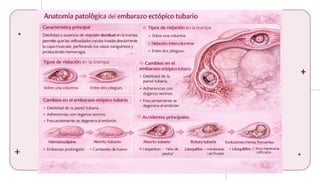 Comprehensive Overview of Ectopic and Molar Pregnancies: Diagnosis ...