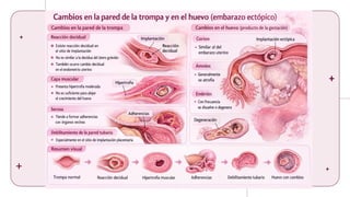 Comprehensive Overview of Ectopic and Molar Pregnancies: Diagnosis ...