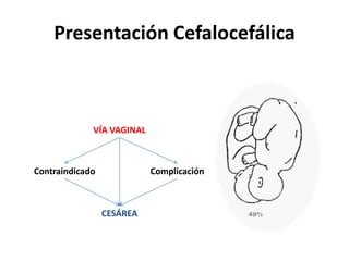 Presentación Cefalocefálica
VÍA VAGINAL
Contraindicado Complicación
CESÁREA
 