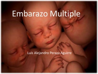 Embarazo Multiple
Luis Alejandro Peraza Aguirre
 