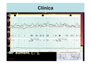 Clínica
•Útero mas grande    •HIE,
(4 cm),
                     •Multiples partes
•Aumento de peso     (Leopold),
no explicado,
                     •Registro de más
•Polihidramnios,     de 1 FCF, con
                     variación > 8 lpm.
•Anemia ferropen.,
•MF aument. (♀*),
 