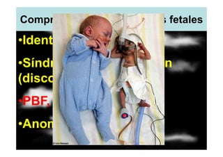 Comprobación de problemas fetales

•Identificar RCIU,
•Síndrome de transfusión
(discordancia de 20%),
•PBF,
•Anomalías,
 