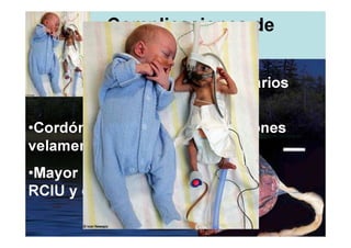 Complicaciones de
          monocigoticos
       •Cortocircuitos placentarios
       (Robo transfusional).
•Cordón de dos vasos e inserciones
velamentosas.
•Mayor probabilidad de
RCIU y de obitarse.
 