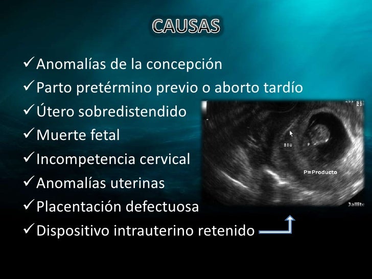 Embarazo Pretérmino – GPC-BE No 140 Manejo de trabajo de parto