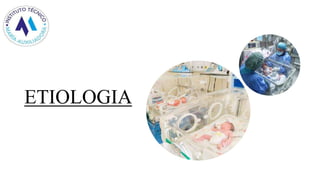 ETIOLOGIA
J
J
 