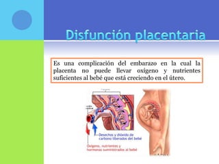 Es una complicación del embarazo en la cual la
placenta no puede llevar oxígeno y nutrientes
suficientes al bebé que está creciendo en el útero.
 