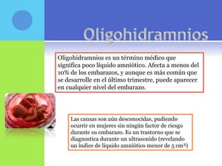 Oligohidramnios es un término médico que
significa poco líquido amniótico. Afecta a menos del
10% de los embarazos, y aunque es más común que
se desarrolle en el último trimestre, puede aparecer
en cualquier nivel del embarazo.




    Las causas son aún desconocidas, pudiendo
    ocurrir en mujeres sin ningún factor de riesgo
    durante su embarazo. Es un trastorno que se
    diagnostica durante un ultrasonido (revelando
    un índice de líquido amniótico menor de 5 cm³)
 