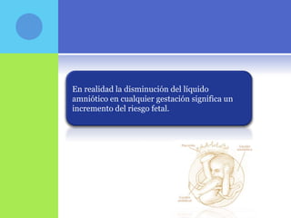 En realidad la disminución del líquido
amniótico en cualquier gestación significa un
incremento del riesgo fetal.
 