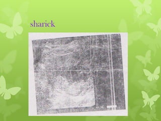 sharick

 