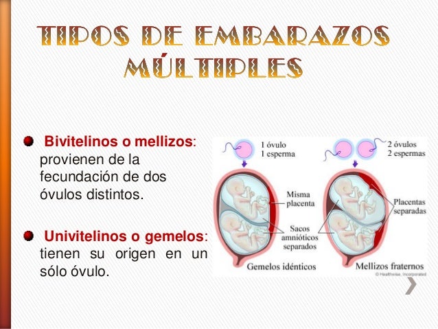 Embarazos Múltiples